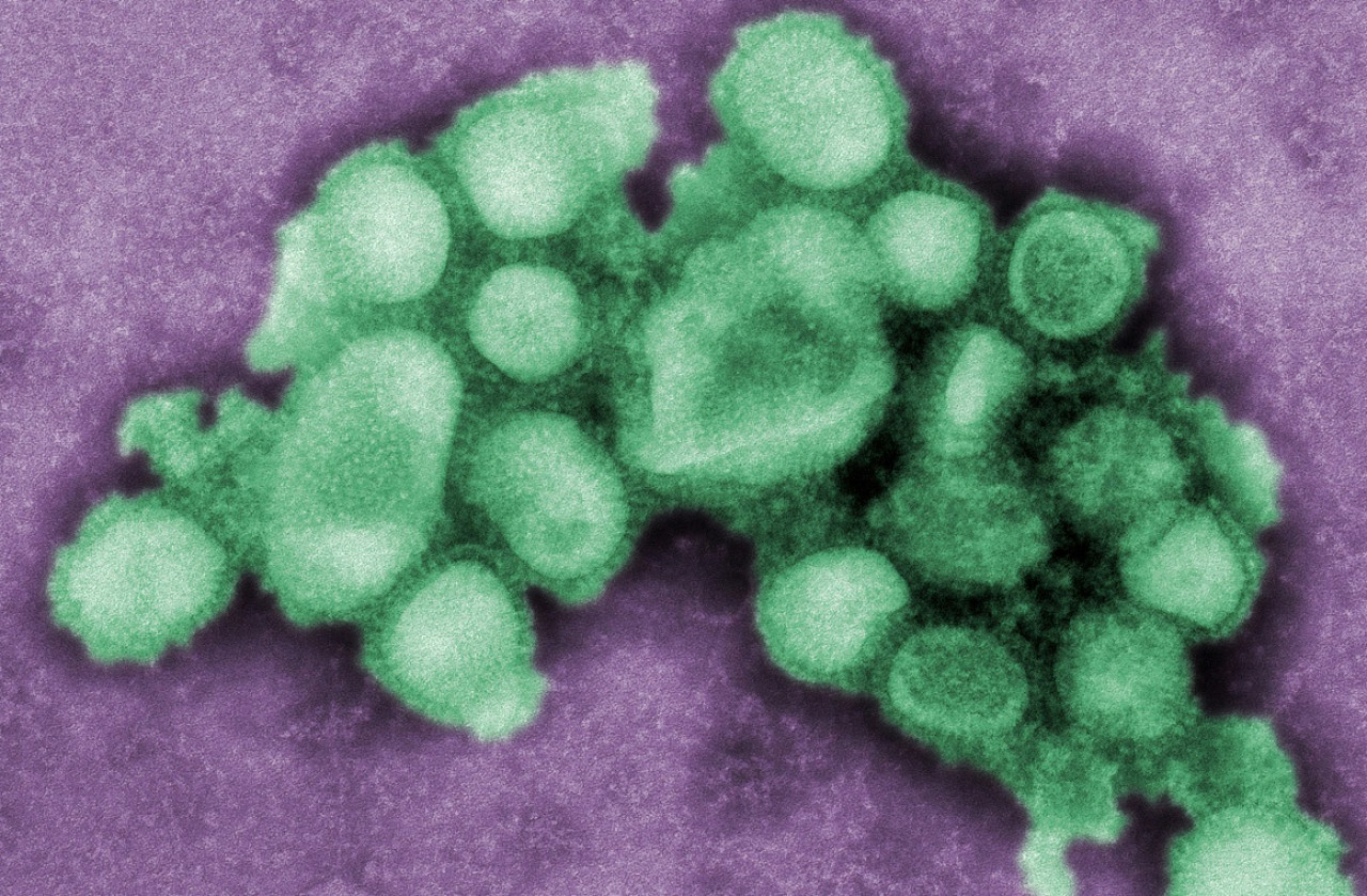 Gripe; microbio; enfermedad. Foto: Unsplash.