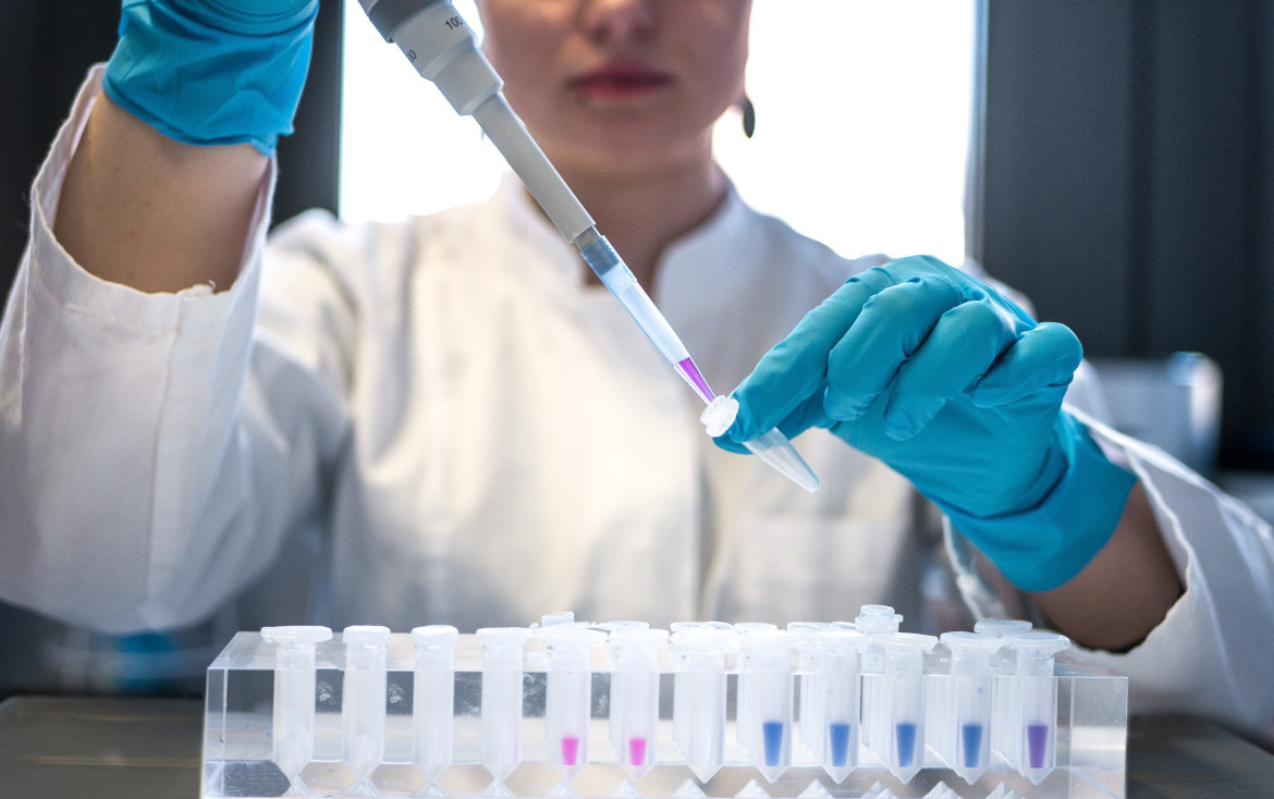 Un test de sangre experimental podría detectar el Alzheimer con más del 90% de precisión. Foto: ilustrativa, Unsplash.
